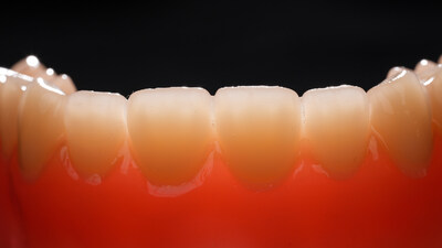 Multi-material denture in detail Multi-material denture in detail