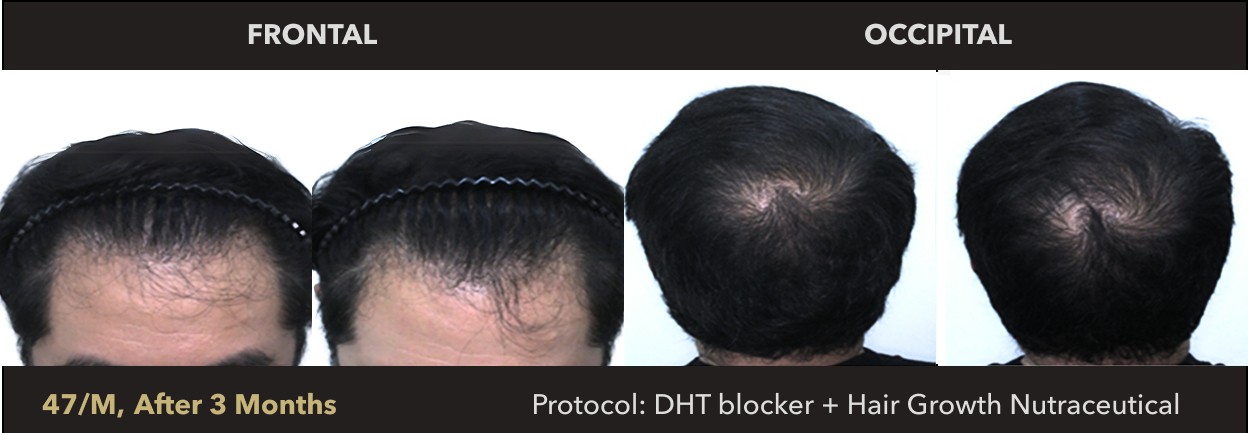 Male, 47 Years Old | Prototype: Essential for Men