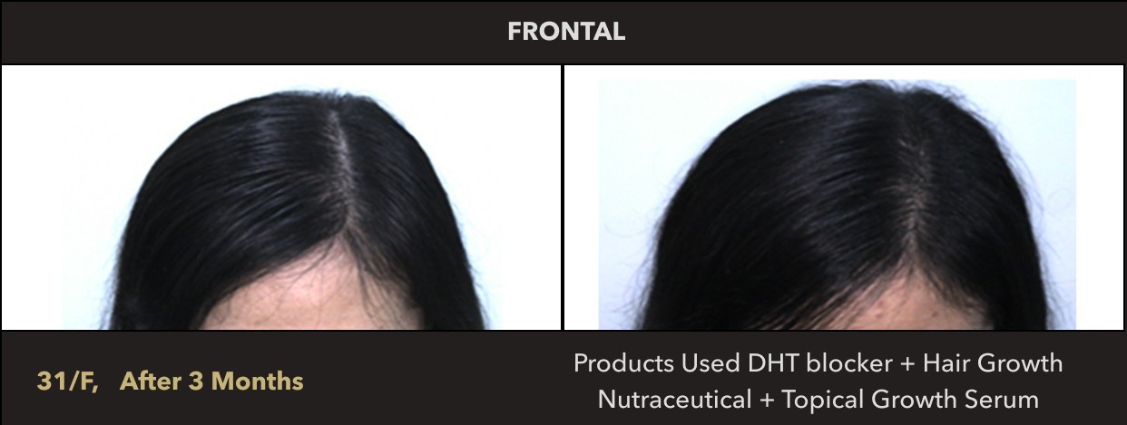 Female, 31 Years Old | Prototype: Essential for Women