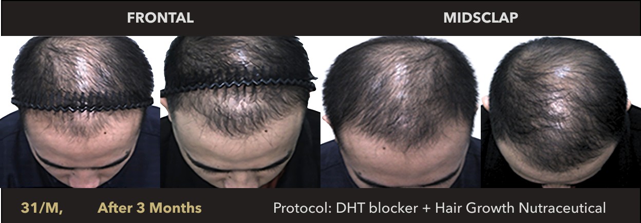 Male, 31 Years Old | Prototype: Essential for Men