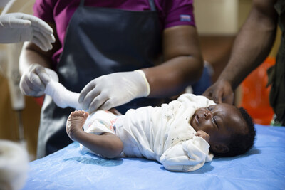 A newborn baby in Liberia with clubfoot receives her first casts.