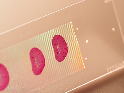 StrataMap Spatial gives customers a spatial solution with a large, flexible capture area, single-cell resolution, and unbiased whole-transcriptome profiling.