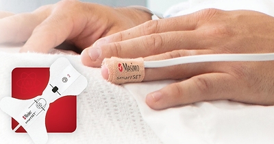 Masimo smartSET™ pulse oximetry with PPG AFib and OIRD Detection